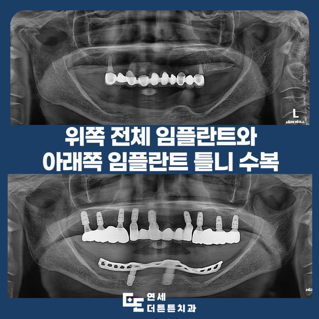 도봉역치과