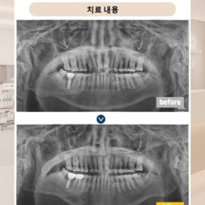 슬라이드12